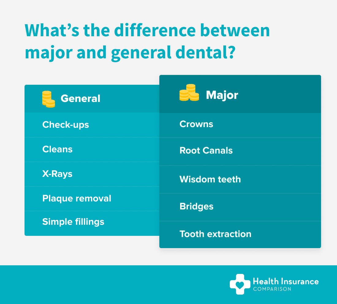 Table showing the difference between general and major dental health insurance extras.
